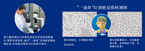 生活中哪些现象说明你的血液粘稠？-激光理疗仪“一滴血”实验-康兴医疗器械官网